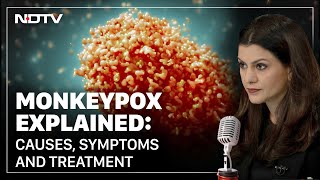 Monkeypox Explained: Causes, Symptoms and Treatment | Hot Mic With Nidhi Razdan