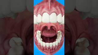 How Tonsil Stones Are Formed #short #tonsilstones - creativelearning3d