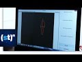 Revolutions in Physical Therapy | SciTech Now
