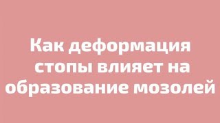 Как деформация стопы влияет на образование мозолей