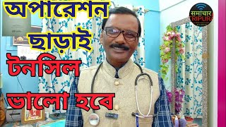 টনসিলের ব্যাথার হোমিও ঔষধ || best homeopathic medicine for tonsillitis || Dr SP Goswami