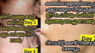 മുഖം വെളുക്കാൻ കഞ്ഞിവെള്ളത്തിനൊപ്പം ഈയൊരു പൊടി ചേർത്ത് മുഖത്ത് തേച്ചു നോക്കു റിസൾട്ട്‌ കിട്ടും