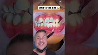 MldBdAWsbvc