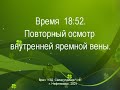 Тромб внутренней яремной вены у пациентов находящихся в коме