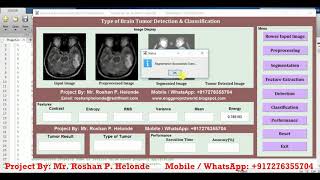 Matlab Code for Type of Brain Tumor Detection and Classification Using Image Processing