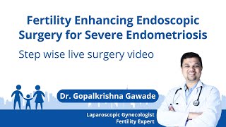 Fertility Enhancing Endoscopic Surgery for Severe Endometriosis | Dr. Gopalkrishna Gawade