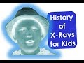 The History of X-Rays For Kids