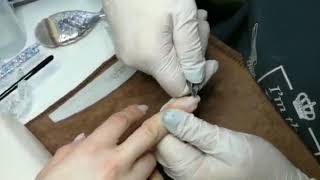 Combined manicure and correction of deformed nails.Комбинированный маникюр и коррекция деформ.ногтей