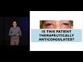 the anticoagulated patient in the ed the advanced em boot camp