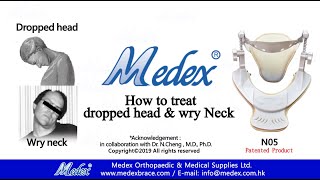 N05 - How to treat dropped head \u0026 wry neck  (3D Animation)