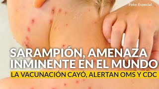 El sarampión es una amenaza inminente en el mundo; vacunación cayó, alertan OMS y CDC