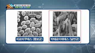 뚱보균과 날씬균의 전쟁!? (엉엉) 내가 살찐 이유는 다 뚱보균 탓이야! | 나는 몸신이다