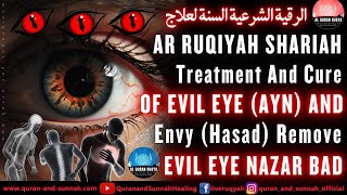 Ultimate Ruqyah Treatment And Cure Of Evil Eye (Ayn) And Envy (Hasad) Remove Evil Eye Nazar E Bad