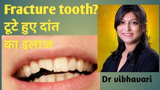 Fractured tooth ? टूटे हुए दांत का इलाज