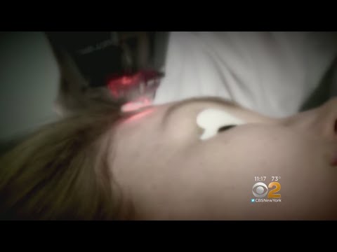 Can lasers give you cancer?