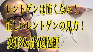 第33回【股関節痛】実は、そんなにレントゲン写真の形って大事じゃないんです！