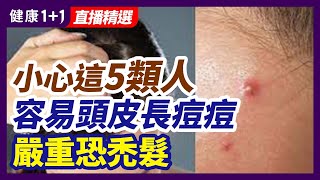 頭皮長痘痘是頭髮沒有洗乾净？季節交換時怎樣改善掉頭髮？| 健康1+1 · 直播