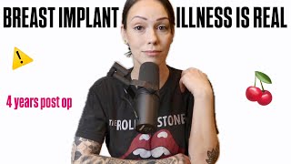 I Am Removing My Implants