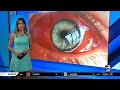 What causes red eyes when swimming?