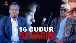 Warraysi Dr Shiine, xanuunada Indhaha