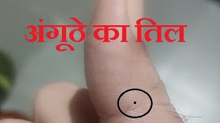 अंगूठे का तिल #hastrekha #palmist #realastrology #jyotish #thumb #til