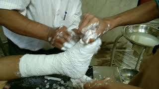 plaster of paris lowar lag middle toe fracture | bengali