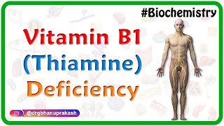 Vitamin B1 (Thiamine) Deficiency - USMLE Biochemistry Vitamins Case Based Discussion
