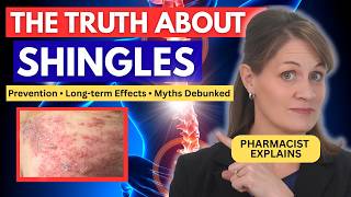 What No One Tells You About Shingles | Pharmacist Explains
