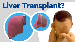 Pediatric Liver Transplant Options