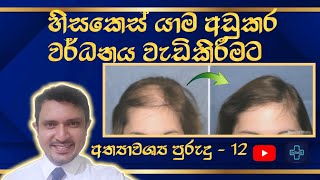 හිසකෙස් වර්ධනයට අත්‍යාවශ්‍ය පුරුදු 12|hair loss treatments|@HealthySkinlk