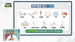 정맥 통증, 일상에서 흔히 겪고 있었다?! 생각보다 훨씬 많은 '정맥 통증 의심증상' | 나는 몸신이다 368 회