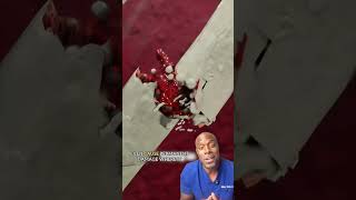 How Fast Do Broken Bones Heal?