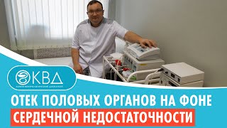 😟 Отек половых органов на фоне сердечной недостаточности. Клинический случай №712