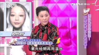 如何保護秀髮？年紀輕輕狂掉髮！頭皮問題大改善 女人我最大 20160201