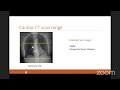 day 2 08 basic of coronary ct by dr. sara tantawy