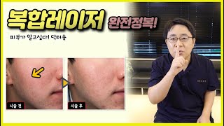 복합레이저치료/콜라겐리모델링의 끝판왕/레이저치료의모든것