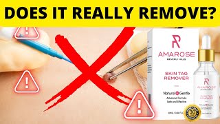 AMAROSE Skin Tag Remove - How to remove moles With Amarose - Amarose review - Amarose Skincare