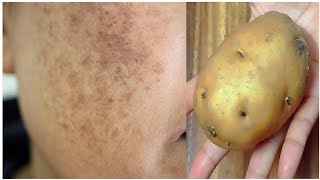 The Japanese secret to skin whitening 10 degrees, remove dark skin, wrinkles and blemishes