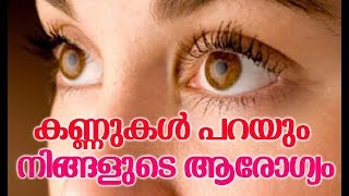 കണ്ണുകൾ പറയും നിങ്ങളുടെ ആരോഗ്യം # Malayalam Health Tips # Health Tips Malayalam