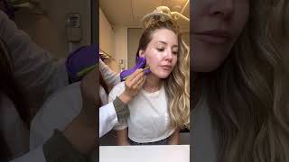 Where you would inject for Masseter Botox