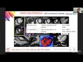 cmr in autoimmune diseases with dr. lilia m. sierra galan