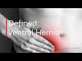 Defined: Ventral Hernia