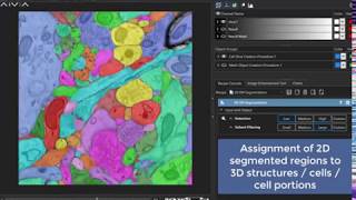 Aivia 6 -  Convolutional neural networks - automated image segmentation - 3D electron microscopy