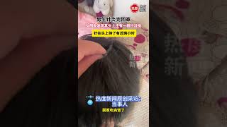 男生针灸完回家，女朋友发现其头上还有一根针没拔，针在头上待了有近两小时