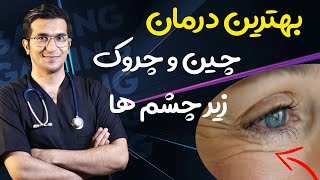 درمان چین و چروک زیر چشم ها با روش های خانگی | STOP WRINKLES and LOOK YOUNGER