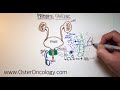 Prostate Cancer - An Illustrative Walk-Thru (A TUTORIAL from Oster Oncology)