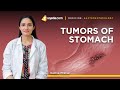 Tumors of Stomach | Gastric Cancer Prevention | Gastroenterology Lecture | V-Learning™