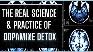Dopamine Detox Examined - The Real Evidence-Based Practices Surrounding Dopamine & Motivation