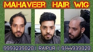 Hair Patch, Hair Wig Clipping, Tapping, Bonding, Fixing, Hair Replacement, Hair Transplant in Raipur