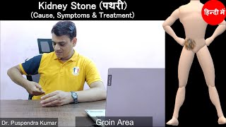 Kidney Stone (पथरी): Cause, Symptoms \u0026 Treatment | Urolithiasis | Nephrolithiasis (In Hindi)